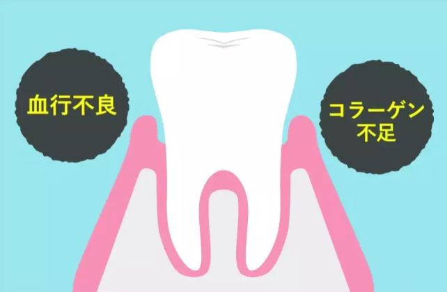歯茎下がりに効く